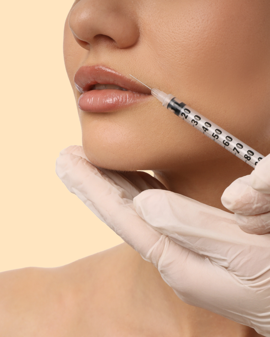 Dermal Fillers — Lips