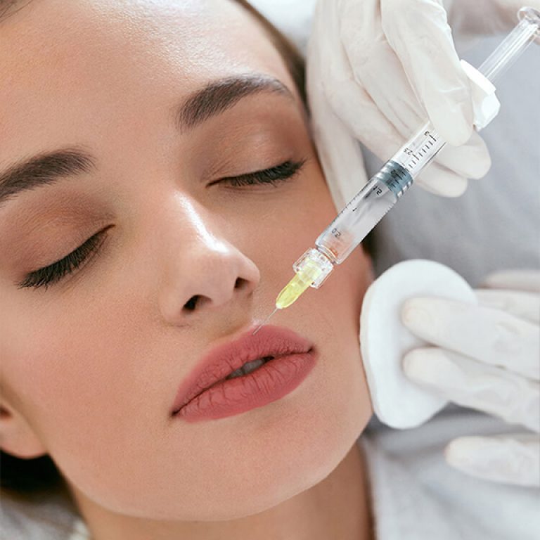 Dermal-Fillers--fillers-for-lips-face